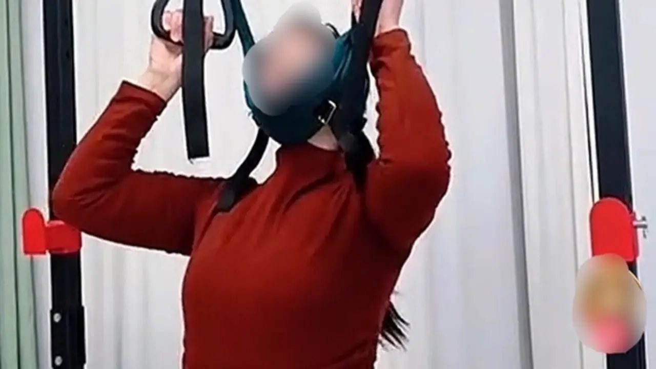 Bác sĩ: 'Treo cổ' chữa thoát vị đĩa đệm coi chừng tổn thương tủy